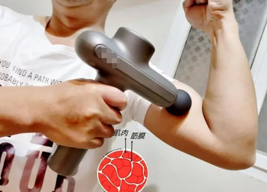 筋膜槍正確使用指南 切莫忽視這三大潛在風險